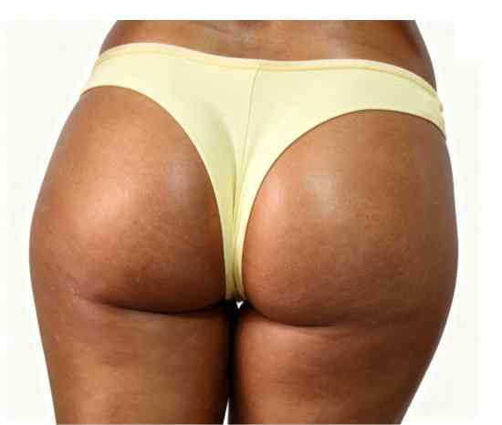 meio corpo de mulher de costas vestida em calcinha colorida fio duplo amarela tamanho médio